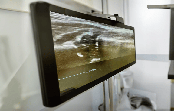 Monitor_ultraschall_test_11zon